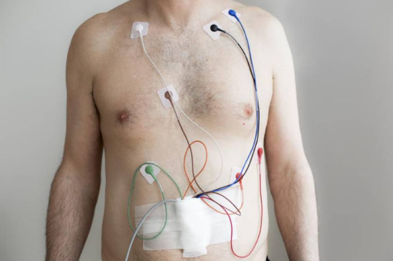 24-hour Holter & Blooda Pressure Monitoring