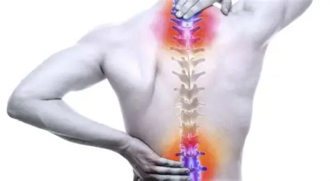 Backpain/spondyolosis
