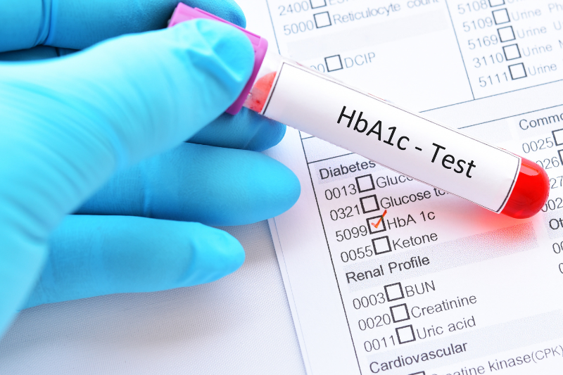 Blood Glucose And Hba1c Test