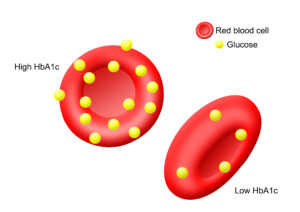 Blood glucose and Hba1