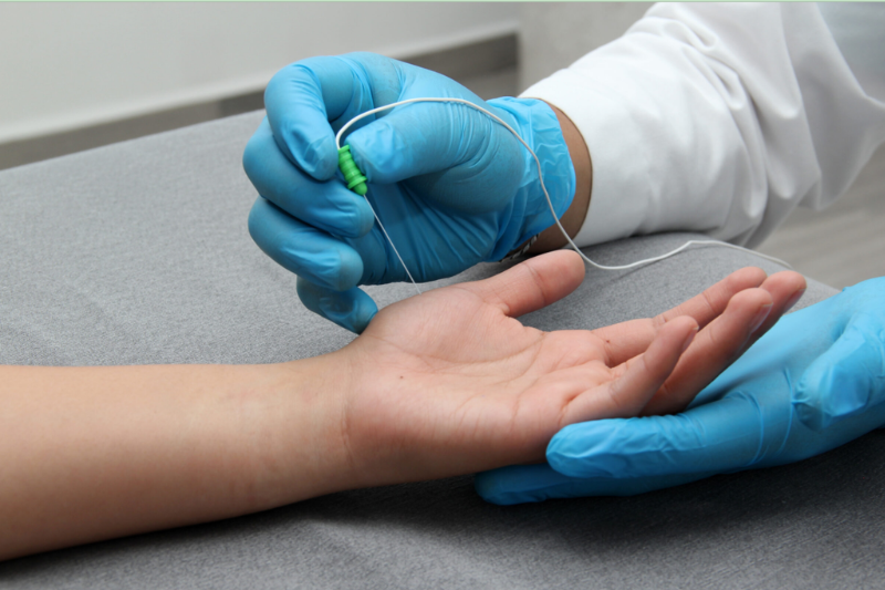 Electromyography EMG