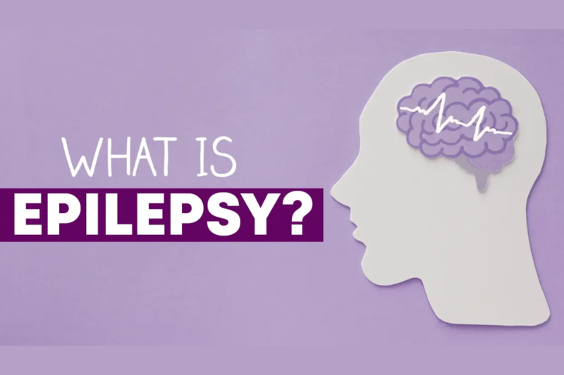 Epilepsy