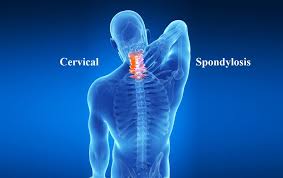 Best Cervical Pain/ Spondylitis In Nagpur