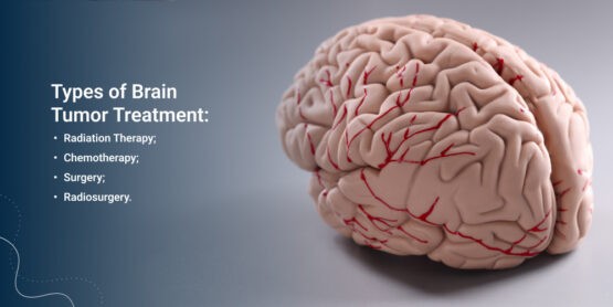 Brain tumor treatment in nagpur