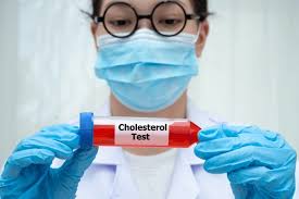 Cholesterol Treatment Doctor In Nagpur